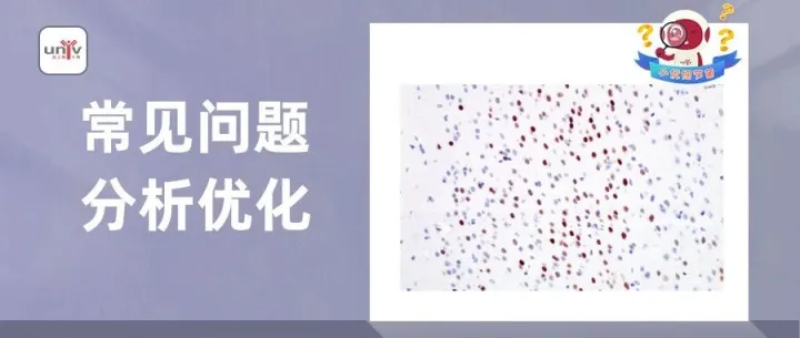 【小优细节君】cFos组化/荧光不好做？一文帮您解决！