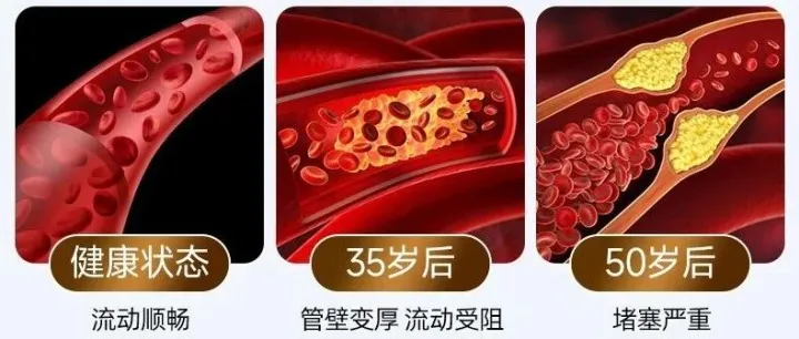 这种对血脂好的脂肪你可能还没吃够