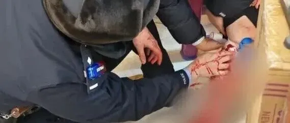 剪开裤子一瞬间，鲜血喷涌而出！哈尔滨街头一小伙血管被冻裂！北方网友着急提醒：记得穿棉裤