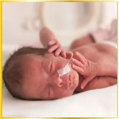 出生仅380克！早产宝宝刷新当地记录