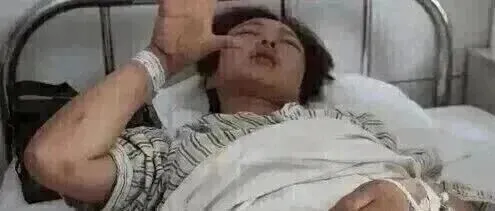 45歲女子確診外陰癌！她的“壞習(xí)慣”為所有人敲響警鐘！值得我們借鑒