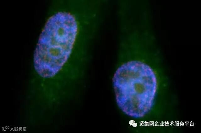 UCLA:发现一种治疗胰腺癌的潜在新联合治疗策略