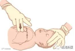 气道异物窒息现场救治,或许身边的你就是孩子唯一的生还希望!