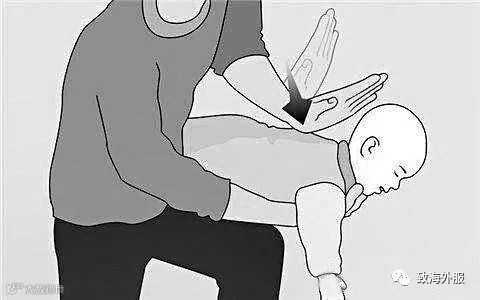 气道异物窒息现场救治,或许身边的你就是孩子唯一的生还希望!