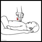 气道异物窒息现场救治,或许身边的你就是孩子唯一的生还希望!