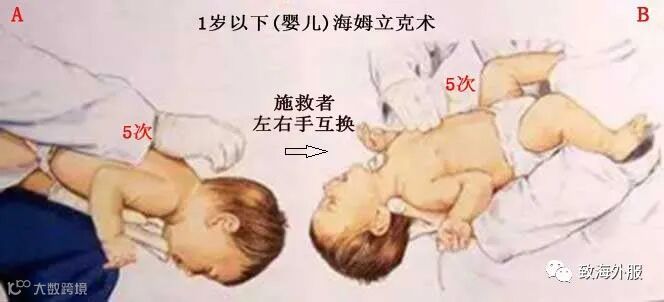 气道异物窒息现场救治,或许身边的你就是孩子唯一的生还希望!