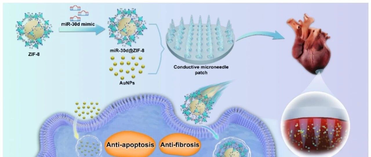 《ACS Nano》miR-30d@ZIF-8/AuNP 导电水凝胶微针：靶向修复心肌缺血再灌注损伤- 大数跨境