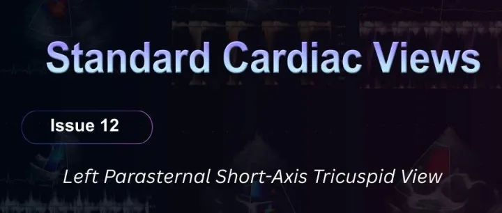 【Vet Cardiac Views 12】Left Parasternal Short-Axis Tricuspid View