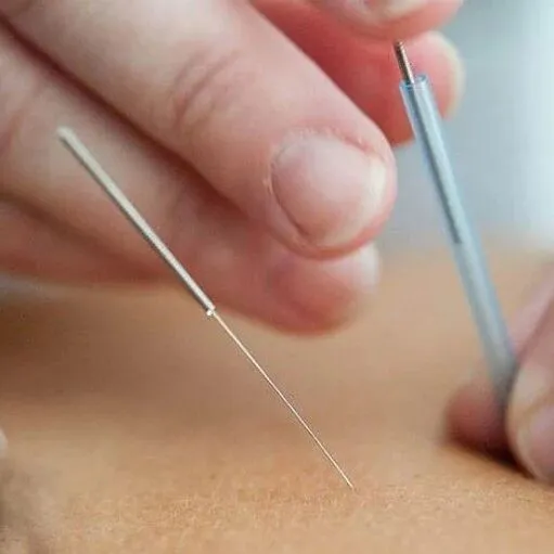 巴西正式规范针灸职业执业管理