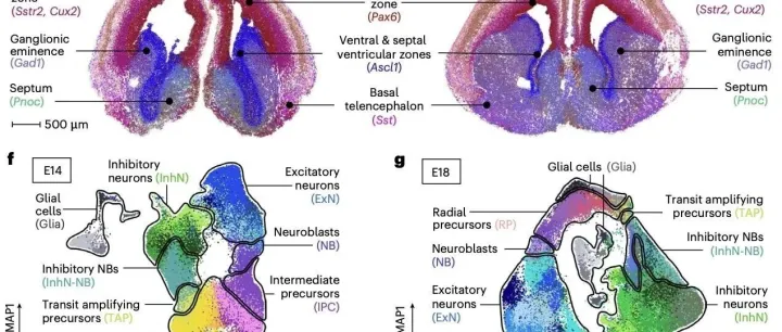 Nat Neuroscience |神经领域的空间组学分析技巧很适合咱们学