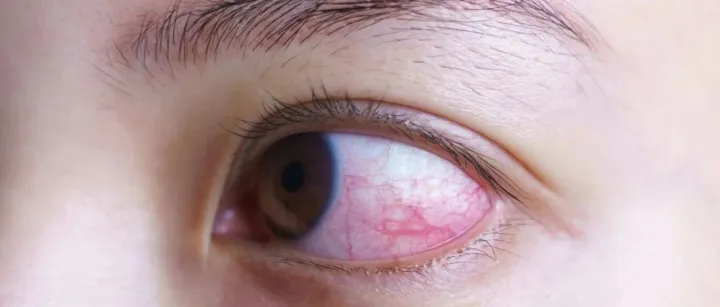 一种巨伤眼的行为，很多女生最近都在做！（不是戴美瞳）