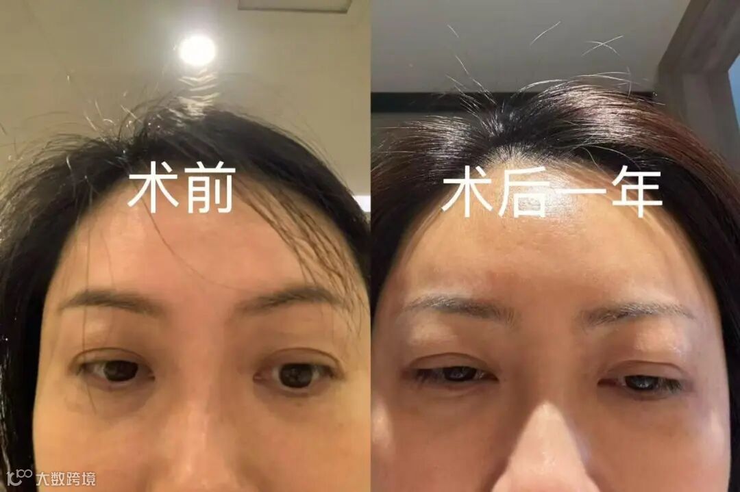 da26ece5a060d4a1f5aedac965b7c5ad