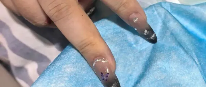 抢救室里，“医生叫来美甲师”引热议！