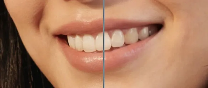 Banana Pro 图像编辑后变模糊 怎么办？