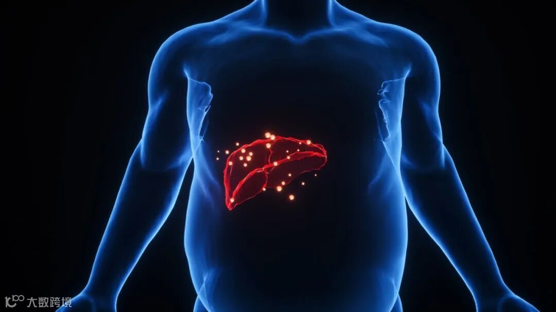 摄图网_401860252_banner_C4D脂肪肝场景（企业商用）.jpg