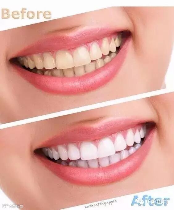 她吃完香蕉随手把皮扔在车内,第二天打开车门惊呆了