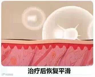 水光注射答疑大全【这些你知道了吗】