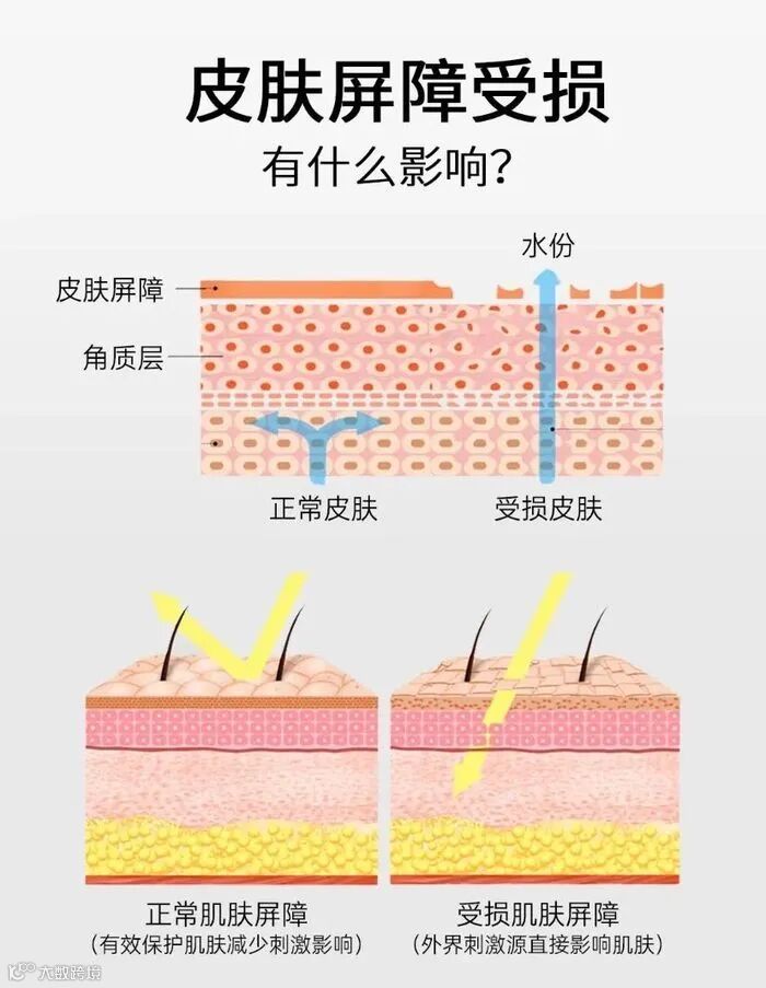 1、 皮肤屏障是什么