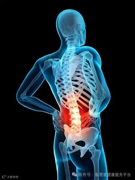 强直性脊柱炎腰疼贴什么膏药_39健康网_风湿科
