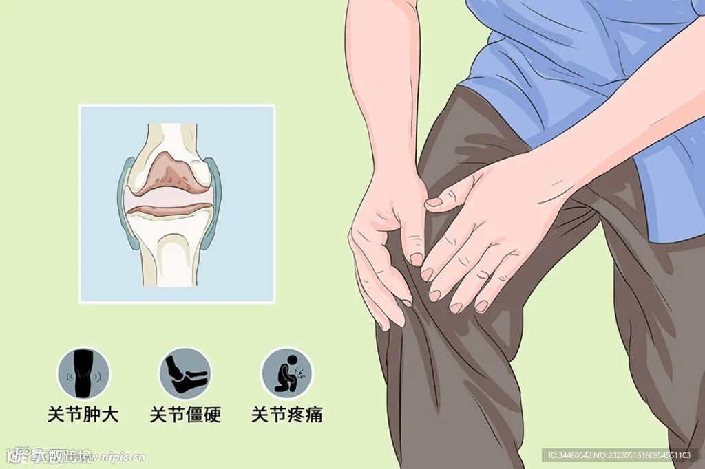 多关节肿胀 疼痛 晨僵摄影图__图片素材_其他_摄影图库_昵图网