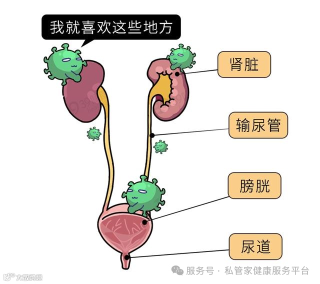 尿频尿急 当心尿路感染！哪些人容易发生？