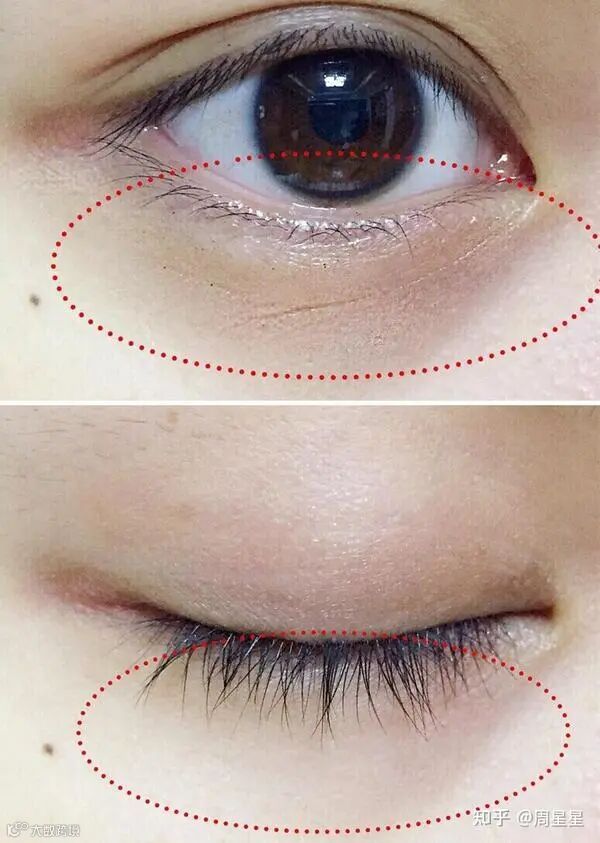 脸上皮肤粗糙有细纹，该如何改善皮肤状况？ - 知乎