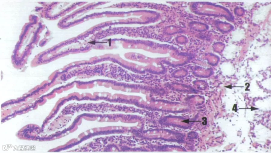 图74 十二指肠-组织学实验-医学