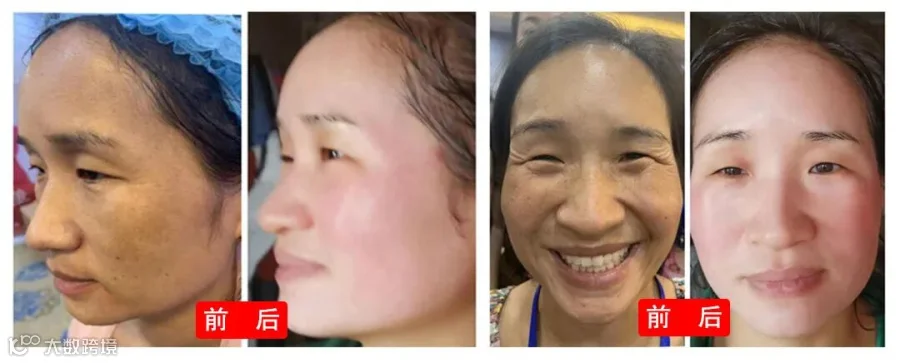 对比.jpg