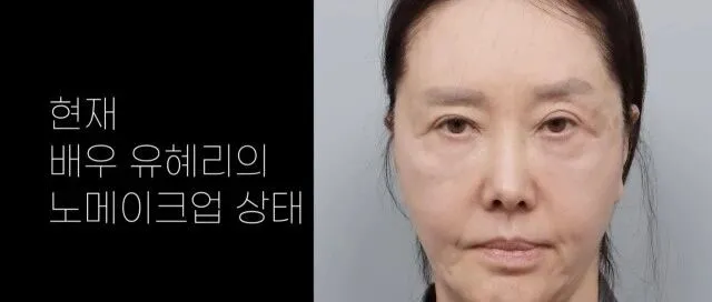 '62세' 유혜리, 안면거상 후 '30대 회춘' 자신감…"안경도 필요 없어"