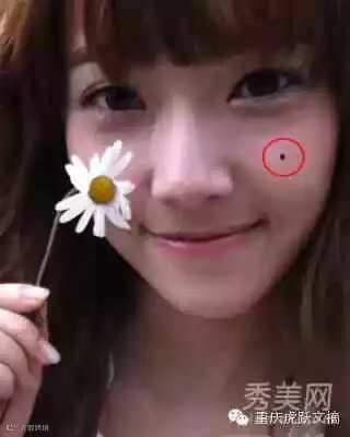 痣相图解:脸上7处痣相暗示财源滚滚