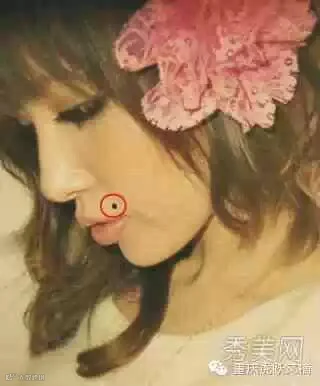 痣相图解:脸上7处痣相暗示财源滚滚