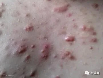 点击查看源网页
