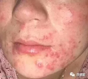 点击查看源网页