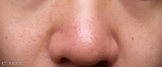 肌肤发黄、缺乏光泽.jpg