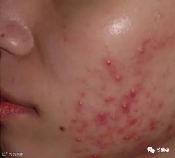 点击查看源网页