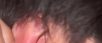 “晚上睡觉，耳朵里的蓝牙耳机爆炸了！”同款在电商平台销量达百万，当事人：70元一副并非低价杂牌，此前未出现异常