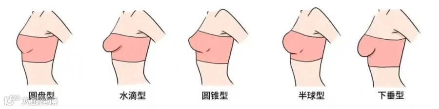 胸部类型去水印.png