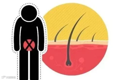女性私处毛毛太密,能刮掉吗 医生说出实话,看完再做决定