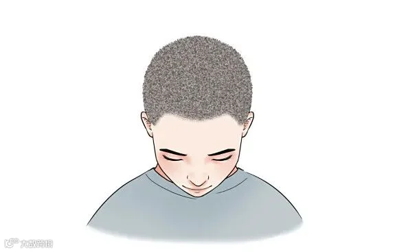 摄图网_401807881_脱发的分类医疗插画(企业商用).jpg