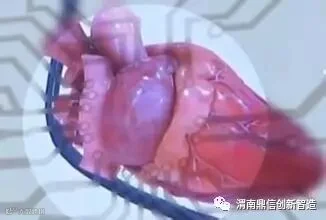 解析基于生物相容性材料的3D打印骨骼修复技术的研究与应用