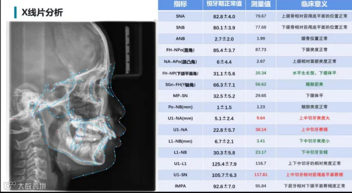 初诊头侧片X线分析