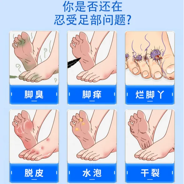 同新堂足康保健液脚气喷剂脚臭脚痒脚烂脚汗草本足部护理皮肤喷雾