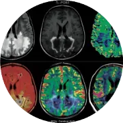 使用TMS-EEG评估小脑与大脑皮层的有效连接性